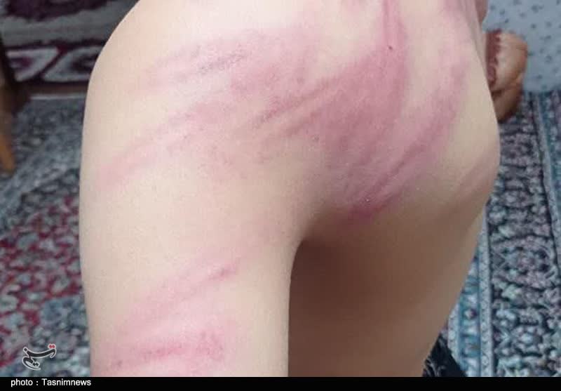 ورود دستگاه قضایی به موضوع ضرب و جرح دانش آموزان روستای کرجو از توابع سنندج